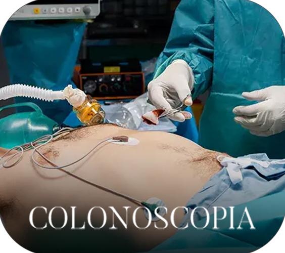 COLONOSCOPÍA
