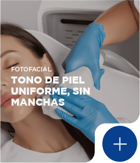 Fotofacial